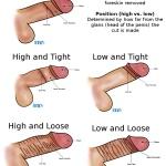 What kind of circumcision do girls like more? and why?