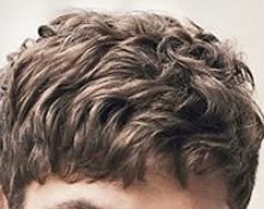 Best hairstyle for receiding hairline?