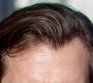 Best hairstyle for receiding hairline?