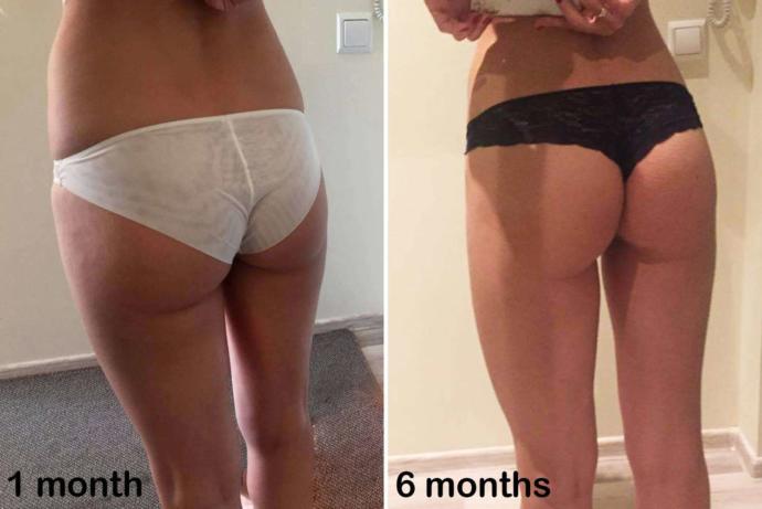 Would you allow a professional to post your undressed photo in his portfolio?