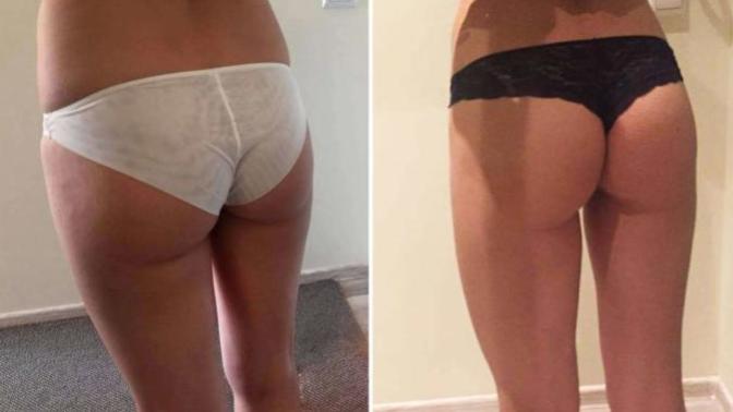 Would you allow a professional to post your undressed photo in his portfolio?
