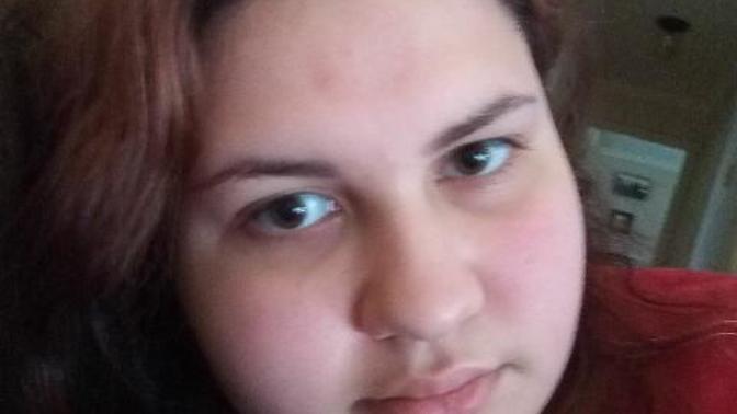 How to hide a mark on the forehead?
