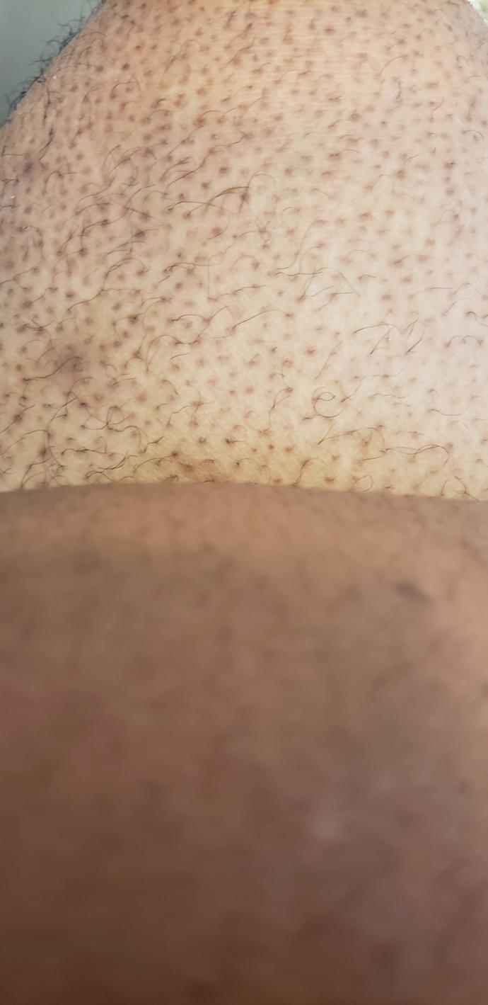 How do I get rid of a tan?