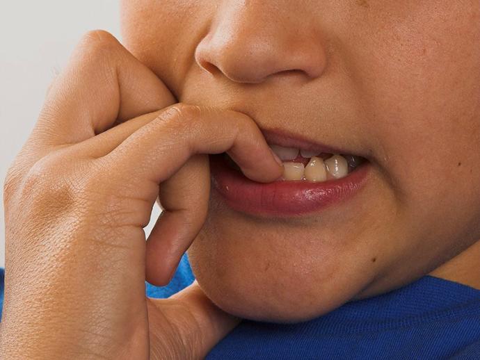 Do you bite your fingernails?
