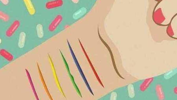 Would you date someone whit self harm scars, or someone whit an eating disorder?