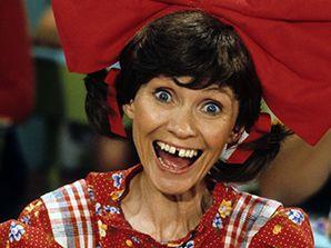 Can a woman still be pretty despite having gap tooth? is it a dealbreaker?