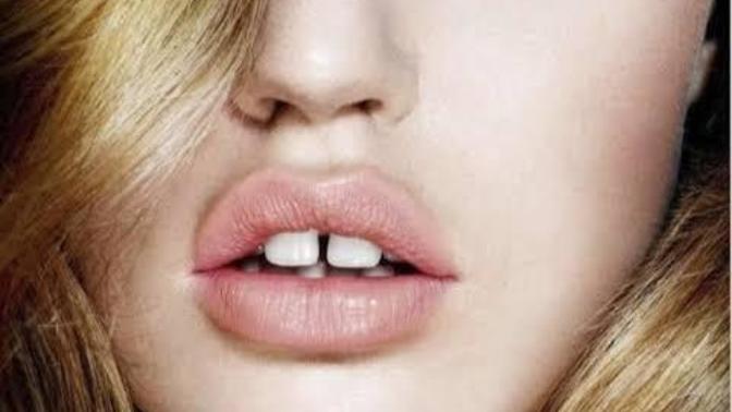 Can a woman still be pretty despite having gap tooth? is it a dealbreaker?