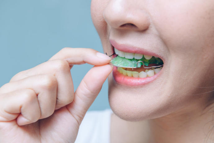 Do you still wear your retainer?