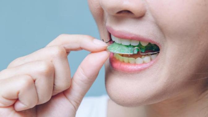 Do you still wear your retainer?