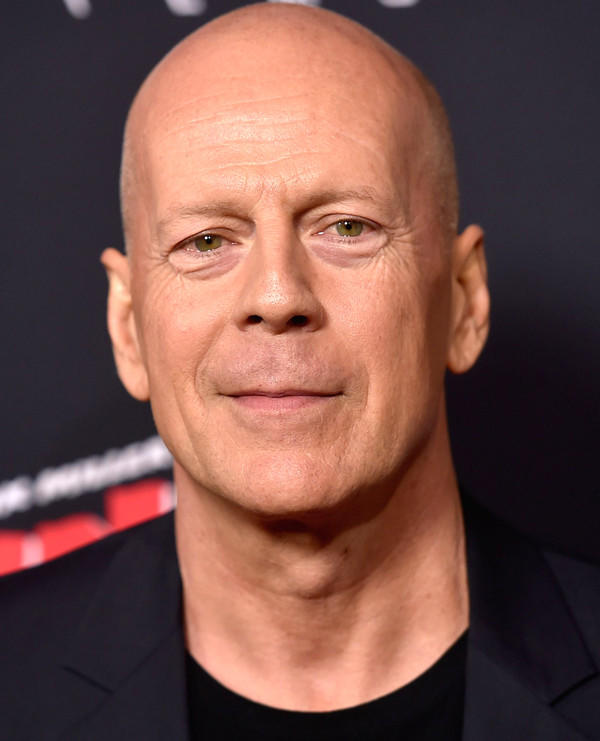 Bald with 3-4 mm sides or 0 mm?