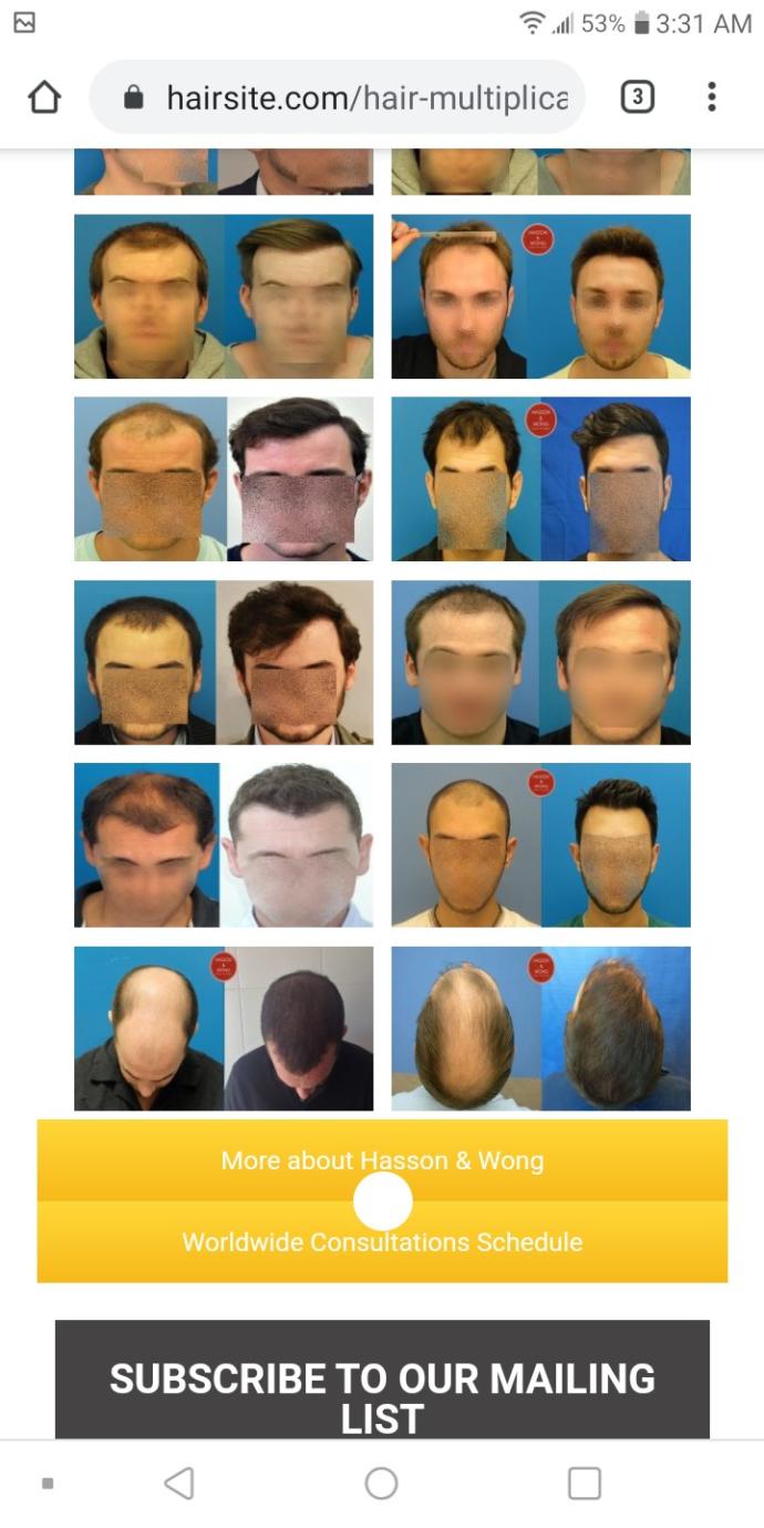 Bald with 3-4 mm sides or 0 mm?
