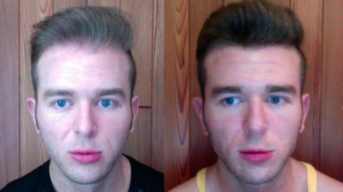 Bald with 3-4 mm sides or 0 mm?
