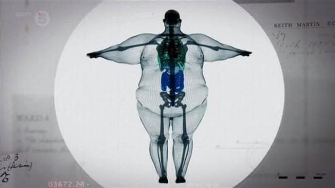 Is there really such a thing as being overweight because of being big-boned?