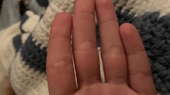 Why are my middle and index fingers so curved?