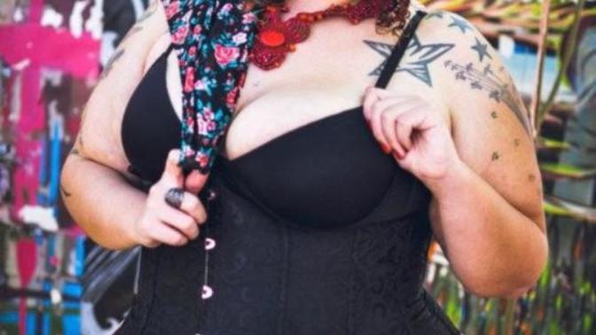 Why are people normalizing obesity?
