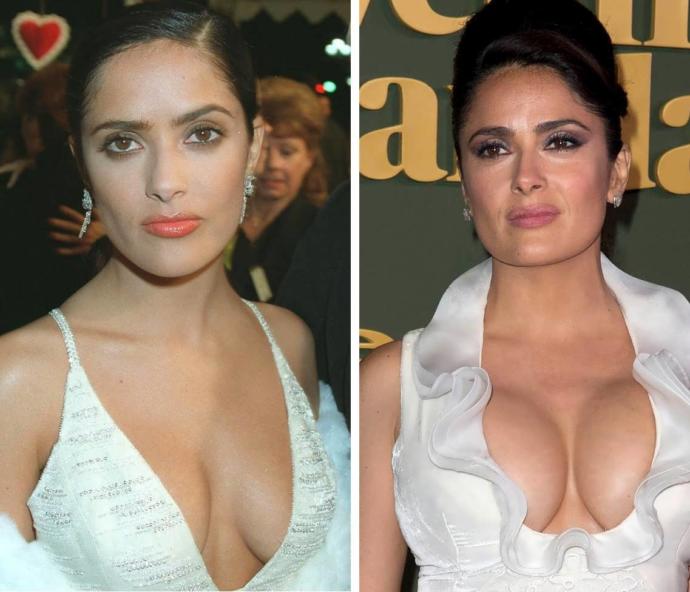 boob job
