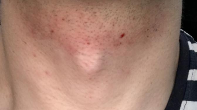 How to prevent this from happening when shaving?