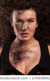 Does This Girl's Acne Make Her Unattractive?