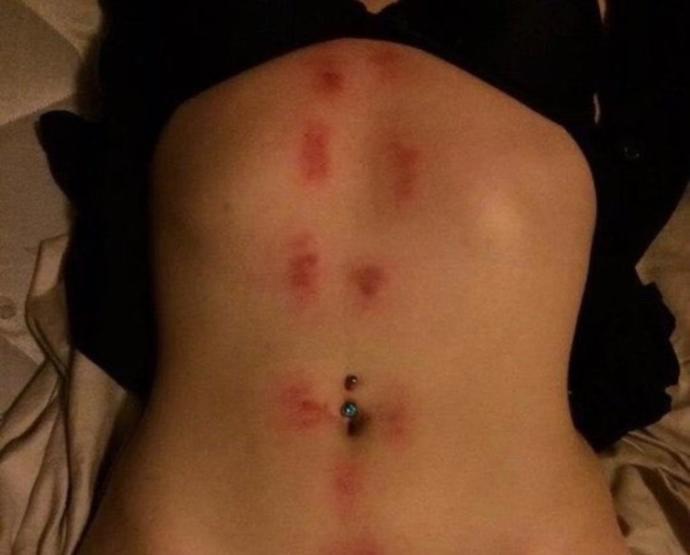 Do you like love bites?