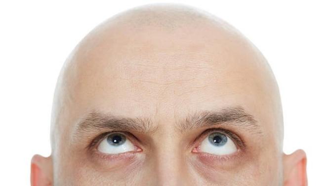 How come men have to be ok with women of all sizes but women can still say they don’t date short bald men?
