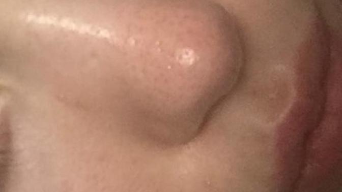 I have two questions about my skin. How can I start to accept my enlarged pores? And why are they white surrounded by brown (not blackheads)?