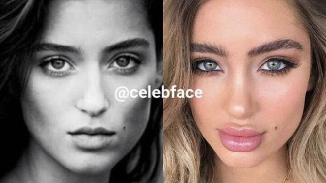 Why is cosmetic surgery hated like a crime?