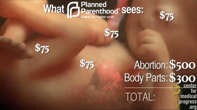 Why are Liberal, Democrats, Socialists , so concerned with virus deaths when they have killed 60 million babies with abortion since 1973?