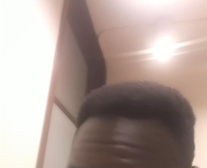 Should I go bald?