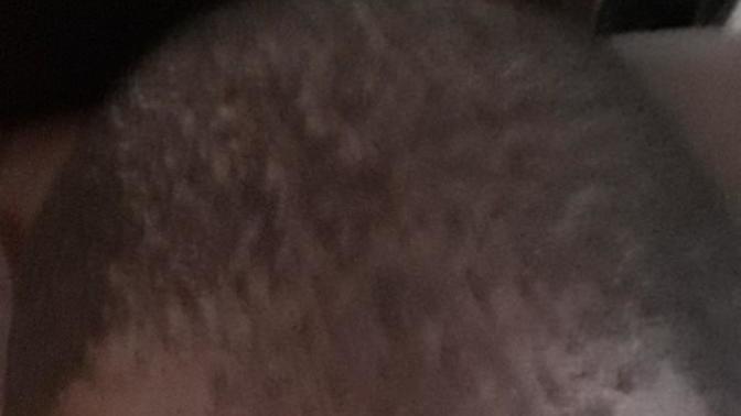 Should I go bald?