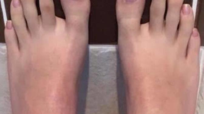 Girls, short or long toenails?