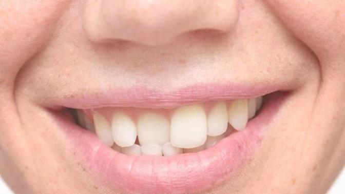 Would you date someone with bad teeth?