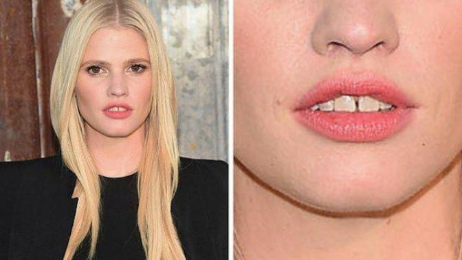 What do you think about a girl with gap between her front teeth?