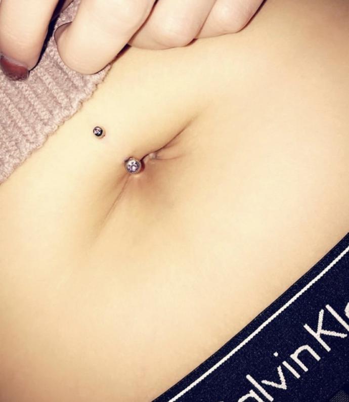 Deformed belly button?