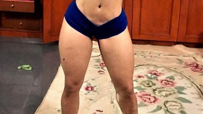 If someone loses a lot of weight and is left with a lumpy tummy would you be ok with it?