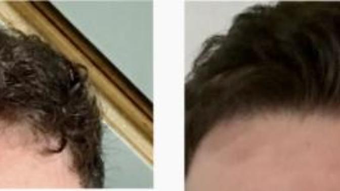 What hairstyle looks the best?