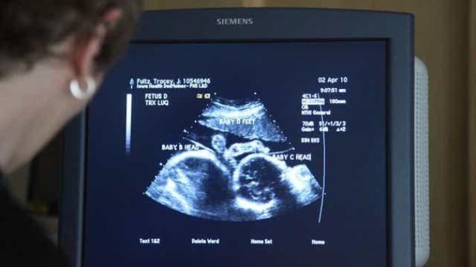 Do you accept or reject the scientific evidence that an embryo and a fetus are both a baby?
