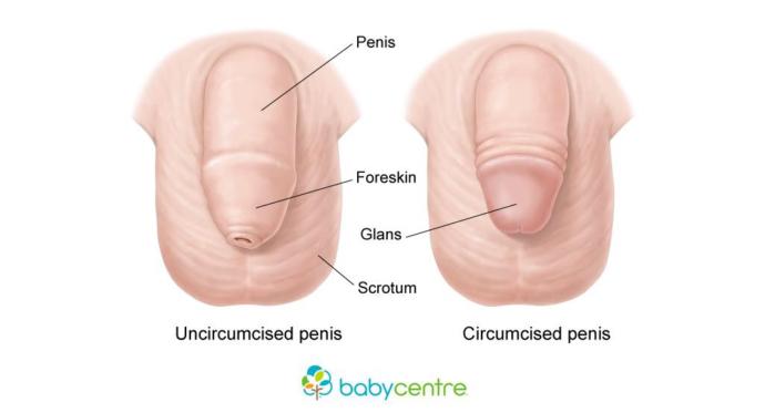 What are your thoughts on circumcision?