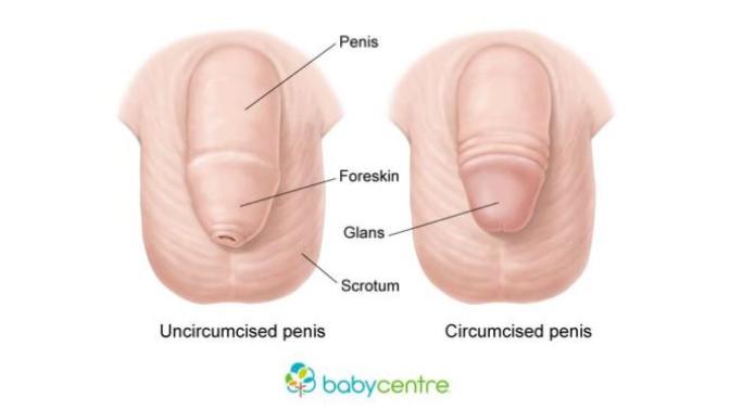 What are your thoughts on circumcision?