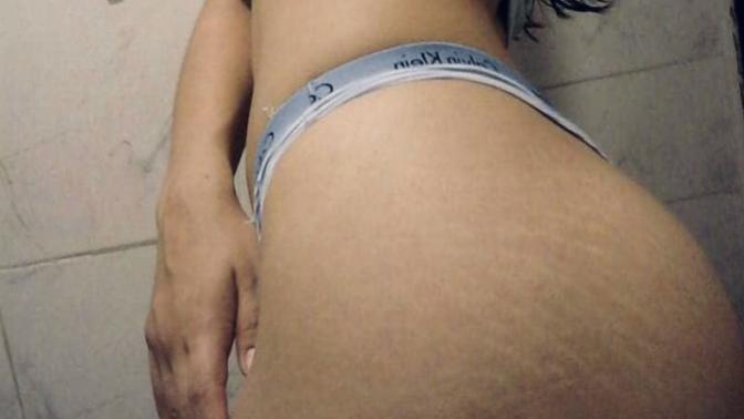 Are “Stretch Marks” Unattractive?