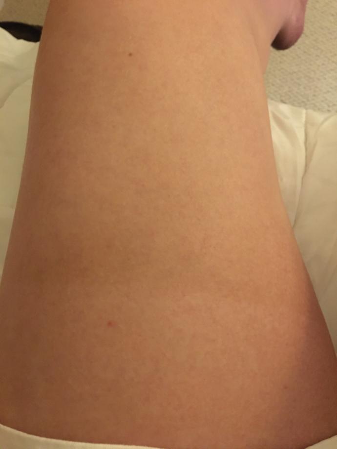 Have you had any terrible tan lines?