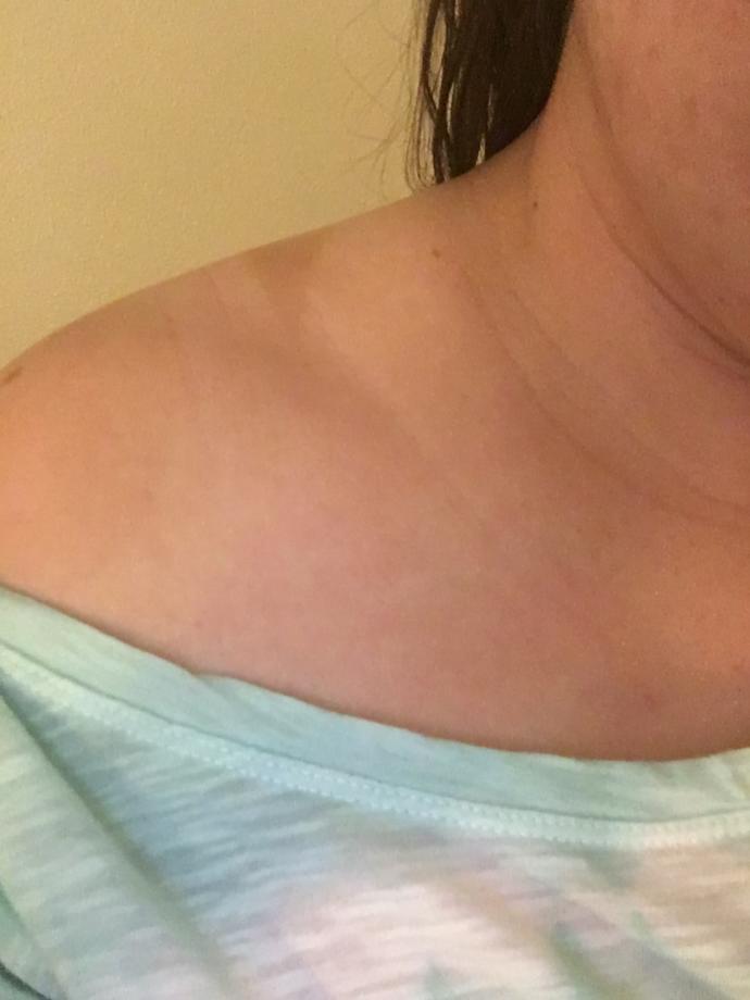 Have you had any terrible tan lines?