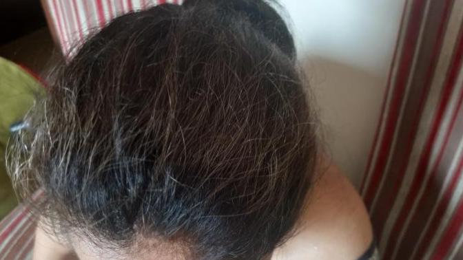 Why hair became like this after dying it?