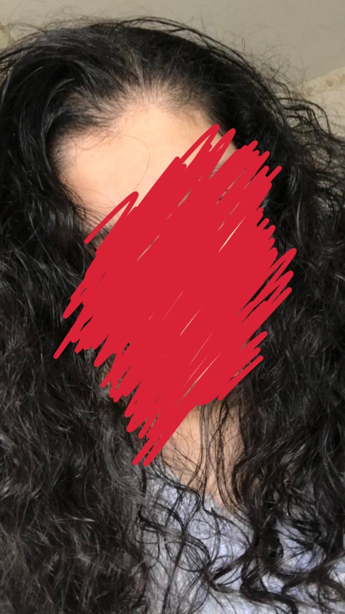 What to do with my bushy, brittle and half oily hair?