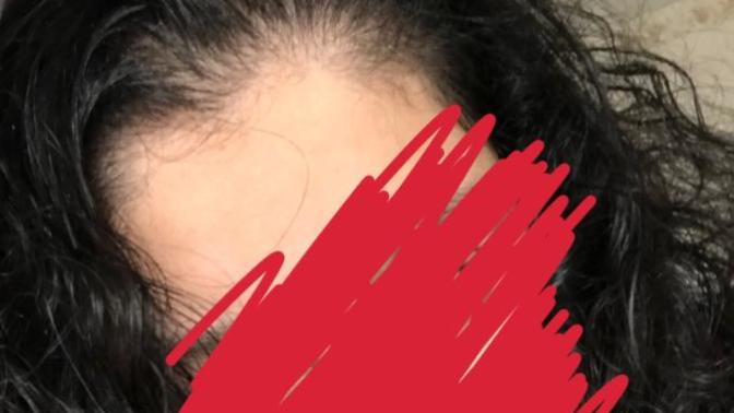 What to do with my bushy, brittle and half oily hair?
