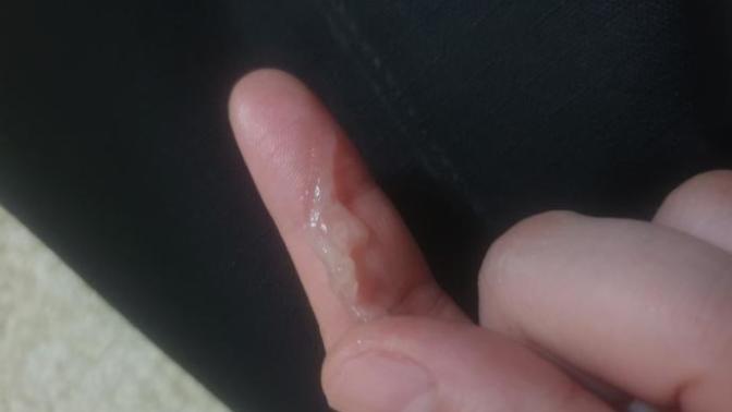 Girls, what are these? Is it normal?
