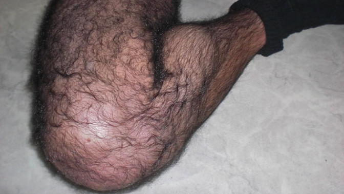 Guys how would you deal if you had very hairy body?