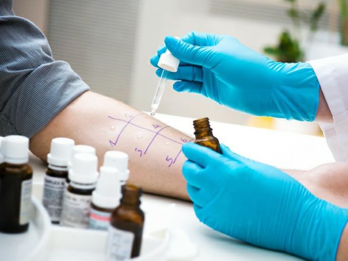 Have you ever been tested for allergies?