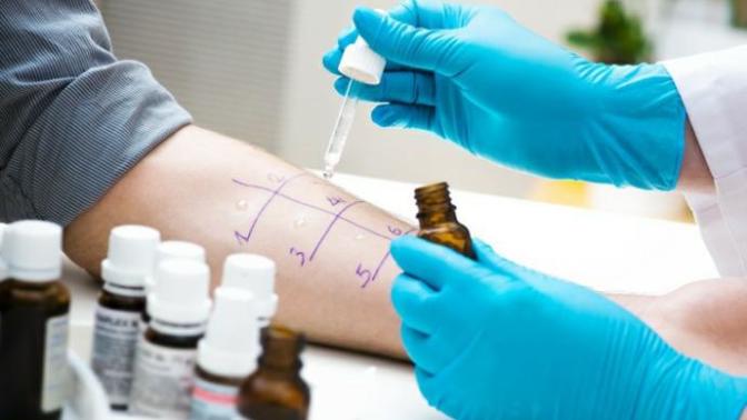 Have you ever been tested for allergies?