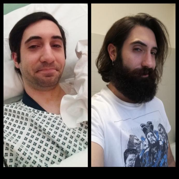 What is the biological function of beards?