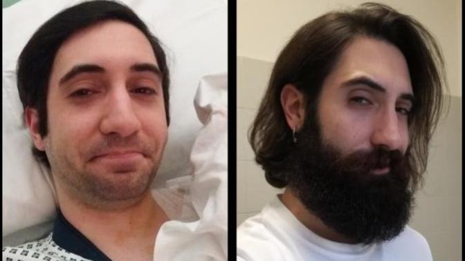 What is the biological function of beards?